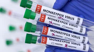 Os pacientes confirmados com a varíola dos macacos estão em isolamento domiciliar - REUTERS/Dado Ruvic