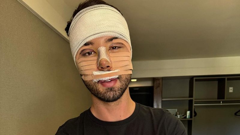 Rico Melquiades revelou resultado das cirurgias plásticas - Instagram/@ricoof