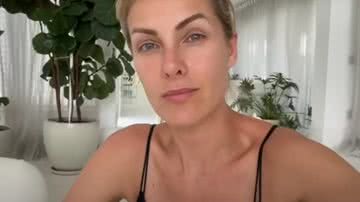 Ana Hickmann foi agredida pelo marido, Alexandre Correia. - Reprodução/Youtube
