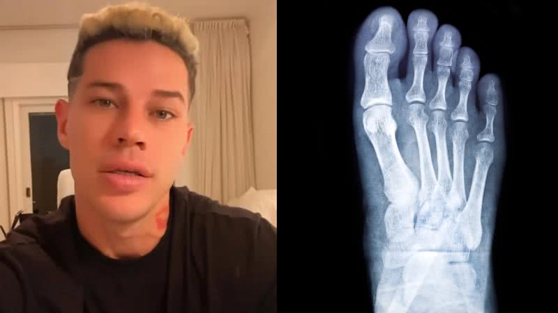 Ortopedista com especialização em pés esclareceu questões à AnaMaria Digital - Reprodução/Instagram e Freepik