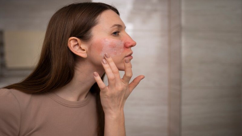 Vermelhidão no rosto? Conheça a rosácea e adeque o skincare - Foto: Reprodução/Freepik