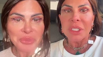 Gretchen exibe olhos vermelhos e inchados após procedimento - Reprodução: Instagram