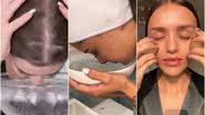 Conheça o skin icing, a técnica de aplicar gelo no rosto que viralizou nas redes sociais - Instagram/TikTok