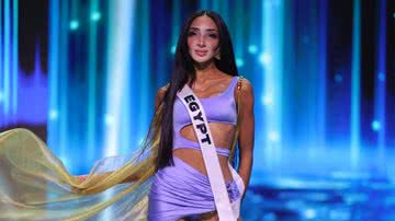 Logina Salah é a primeira participante do Miss Universo com vitiligo; saiba tudo sobre condição! - Reprodução/Instagram