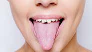 Sintomas do mal-estar na ponta da língua - iStock