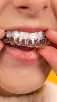 Como funciona o aparelho invisível de dentes