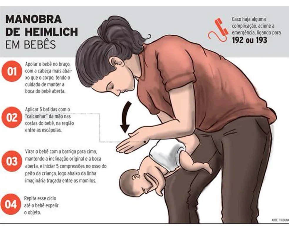como fazer manobra de heimlich em bebês