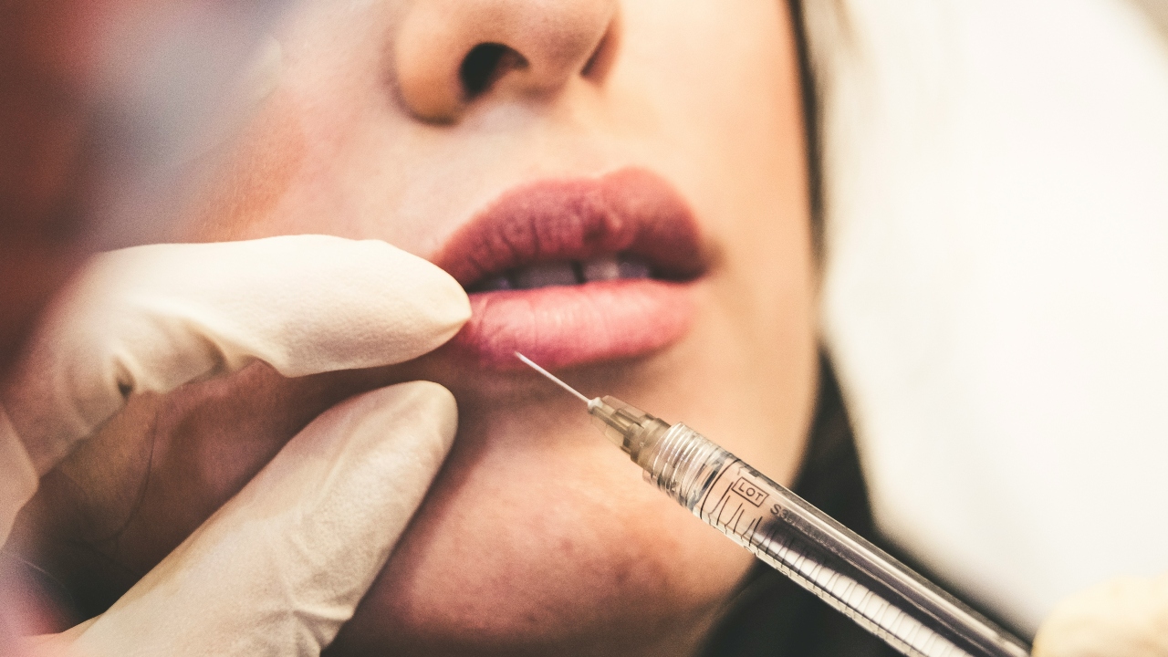 Dermatologista indica procedimentos que podem resolver os lábios rachados do frio