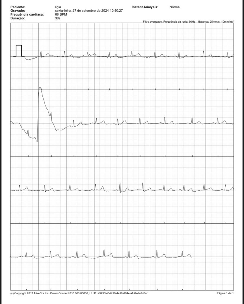 Máquina de eletrocardiograma portátil