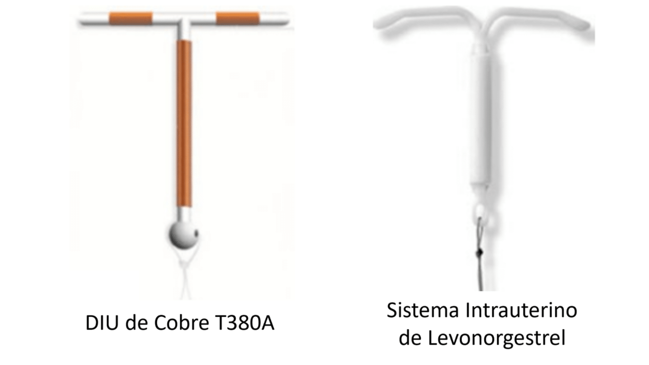 Saiba as diferenças entre o DIU de Cobre e o DIU Hormonal