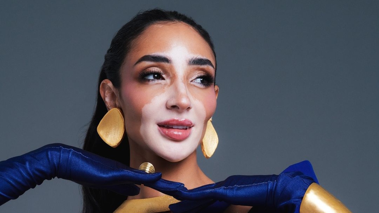 Logina Salah entra para história como primeira participante do Miss Universo com vitiligo