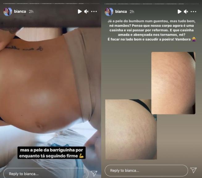 Bianca Andrade mostra estrias e revela como tem lidado com elas