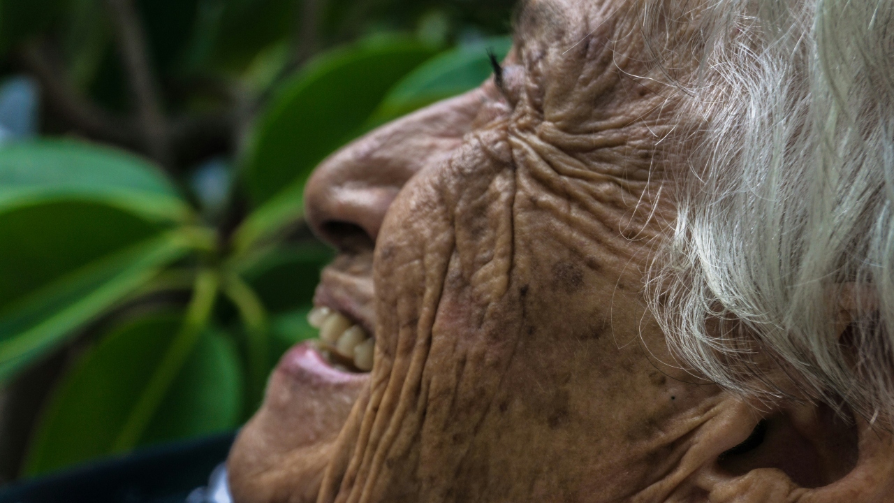 Envelhecimento da pele: pintas e manchas não são a mesma