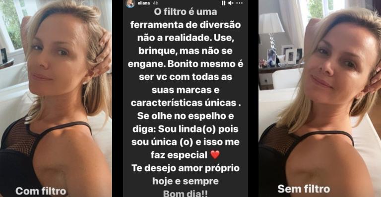 Eliana compartilha fotos com e sem filtro para trazer reflexão sobre auto estima e amor próprio