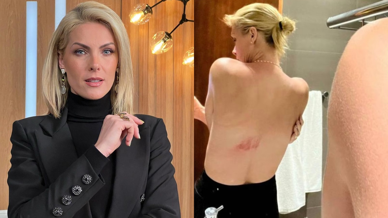 Instagram/@ahickmann