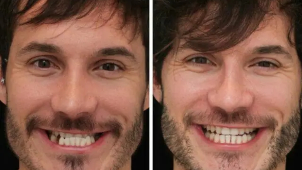 Antes e depois