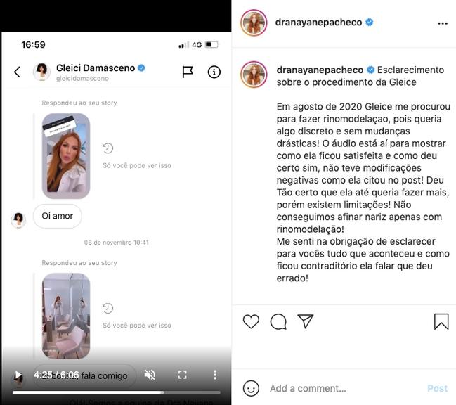 Cirurgiã desabafa sobre reclamações de Gleici Damasceno sobre nariz, na web