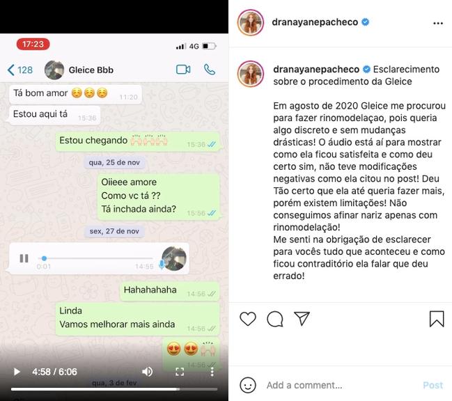 Cirurgiã desabafa sobre reclamações de Gleici Damasceno sobre nariz, na web