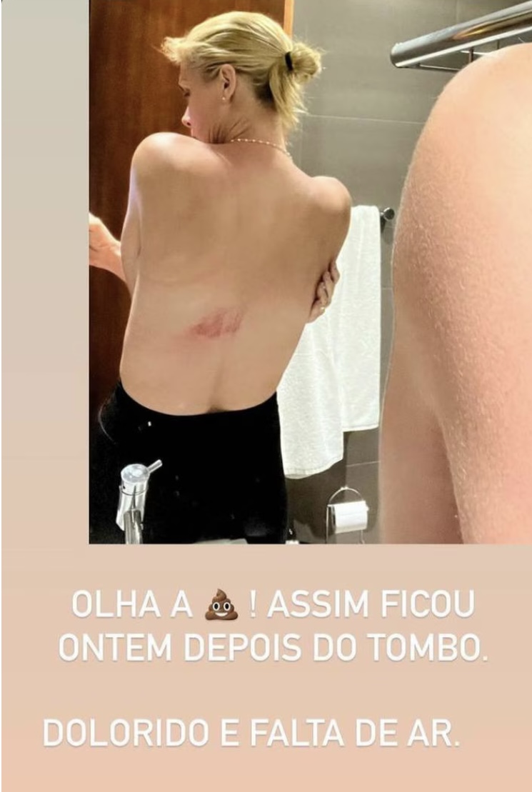 Stories Ana Hickmann
