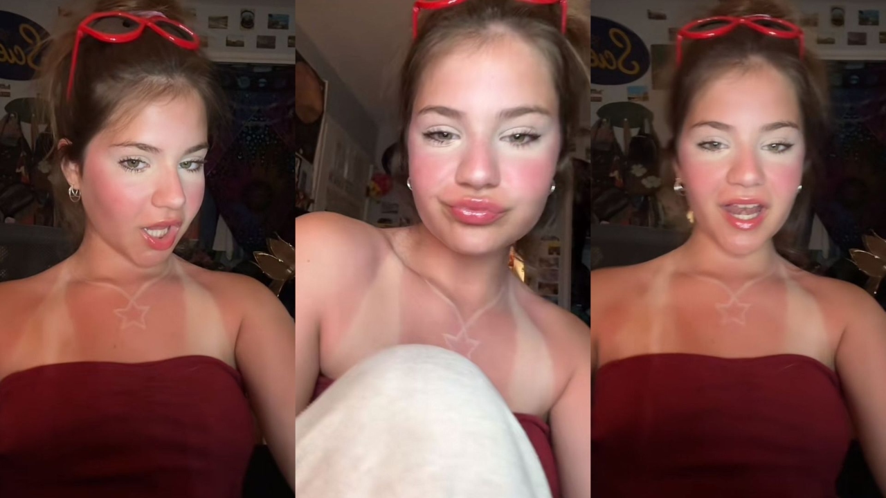 sunburn makeup