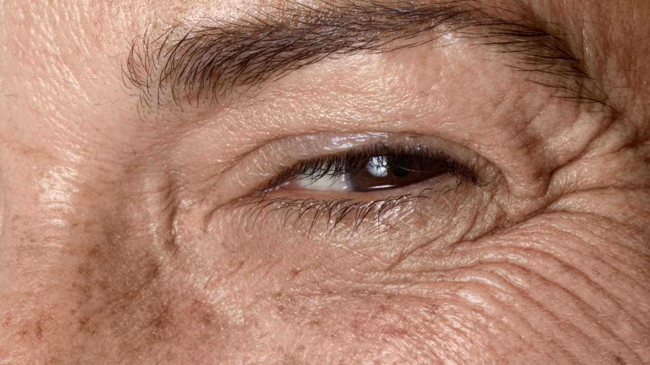 tipos de peeling