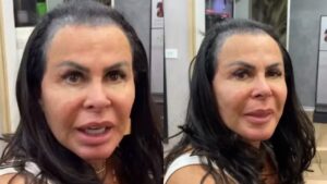 Alopecia: entenda condição que provoca queda de cabelo. Imagem: reprodução