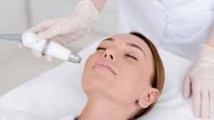 Peeling de fenol, milagroso ou perigoso? Desvendando os riscos