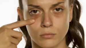 Olhos Jovens, diga adeus a olheiras e rugas!