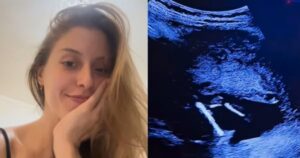 Bebê chuta DIU na barriga da mãe: médica explica caso polêmico