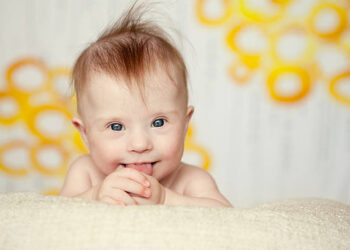 cheerful little baby girl with Downs Syndrome