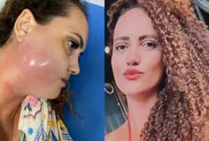 Cirurgião explica caso da jovem morta após procedimento dentário
