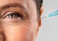 botox estético