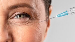 botox estético