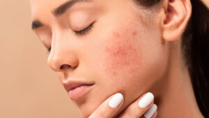 Como cuidar da pele sensível e evitar irritações com uma rotina simples