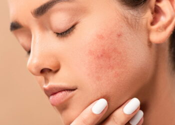 Como cuidar da pele sensível e evitar irritações com uma rotina simples