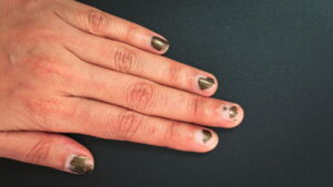 O que suas unhas dizem sobre você? Descubra os sinais que elas revelam!