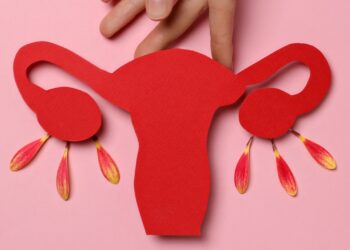 endometriose