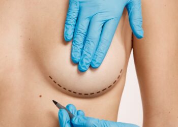 cirurgia das mamas