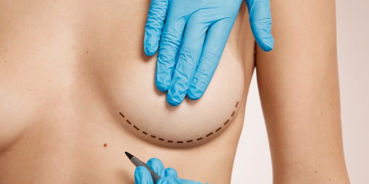 cirurgia das mamas