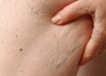 Pele seca? Aprenda a hidratar com ingredientes naturais