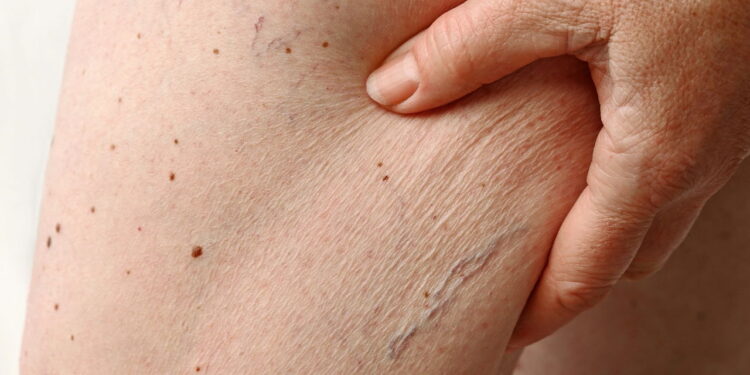 Pele seca? Aprenda a hidratar com ingredientes naturais
