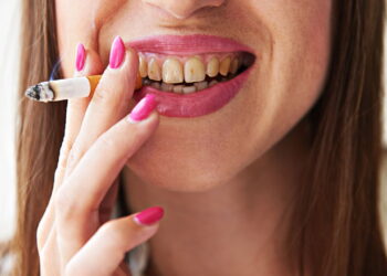 Mulher com os dentes amarelos - Créditos: depositphotos.com / konstantynov