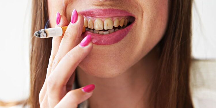 Mulher com os dentes amarelos - Créditos: depositphotos.com / konstantynov