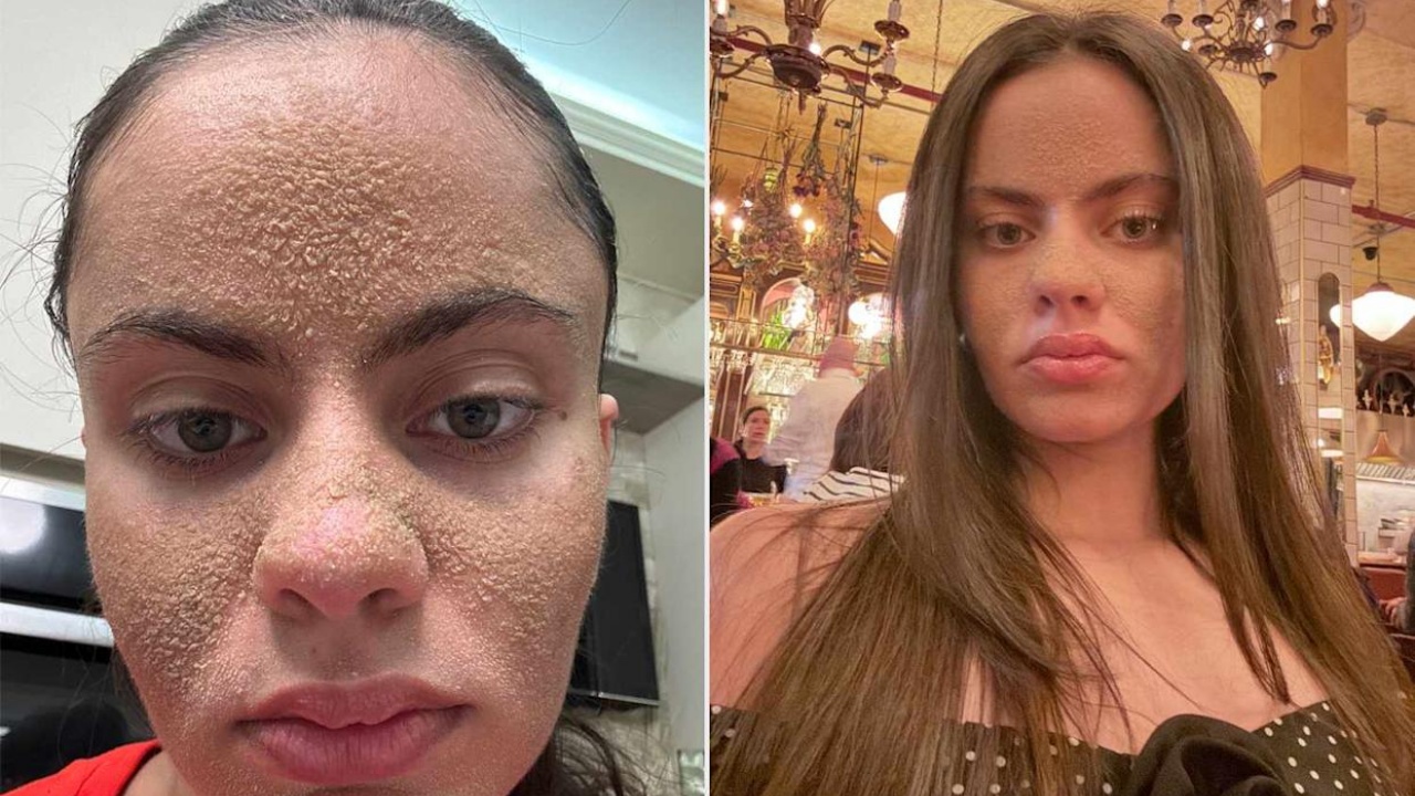 skincare