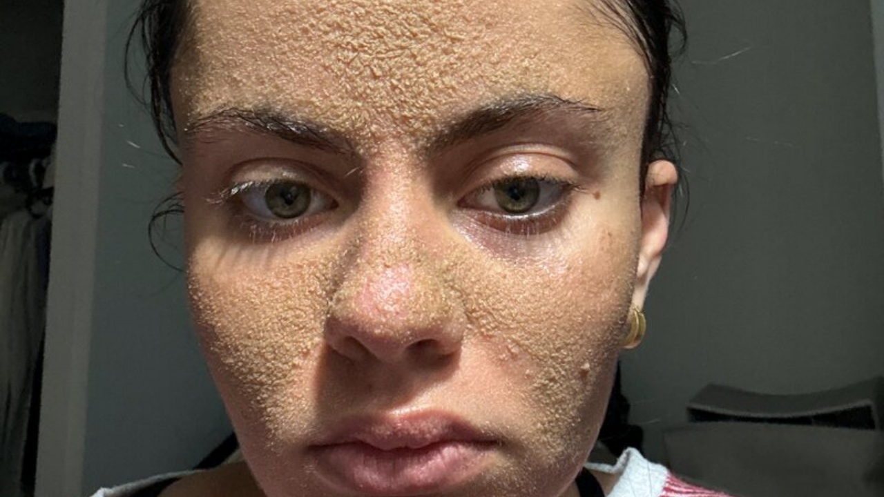 skincare