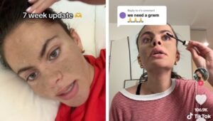 skincare