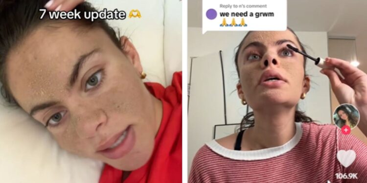 skincare