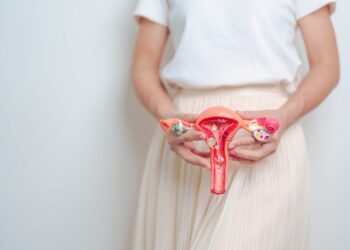Mudanças na alimentação para aliviar a dor da endometriose