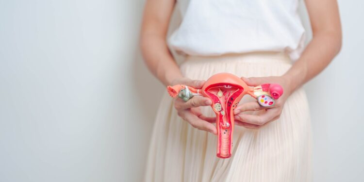 Mudanças na alimentação para aliviar a dor da endometriose