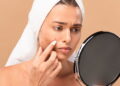 Como usar maquiagem sem piorar a acne